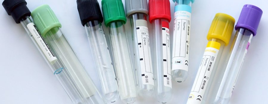 High-quality-cheap-price-vacutainer-blood-collection